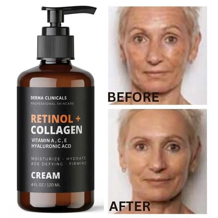 Derma Clinicals Retinol + Collagen Cream – Vitamins A, C, E & Hyaluronic Acid Anti-Aging Moisturizer (4 oz) - GLOW FIT ESSENTIALS