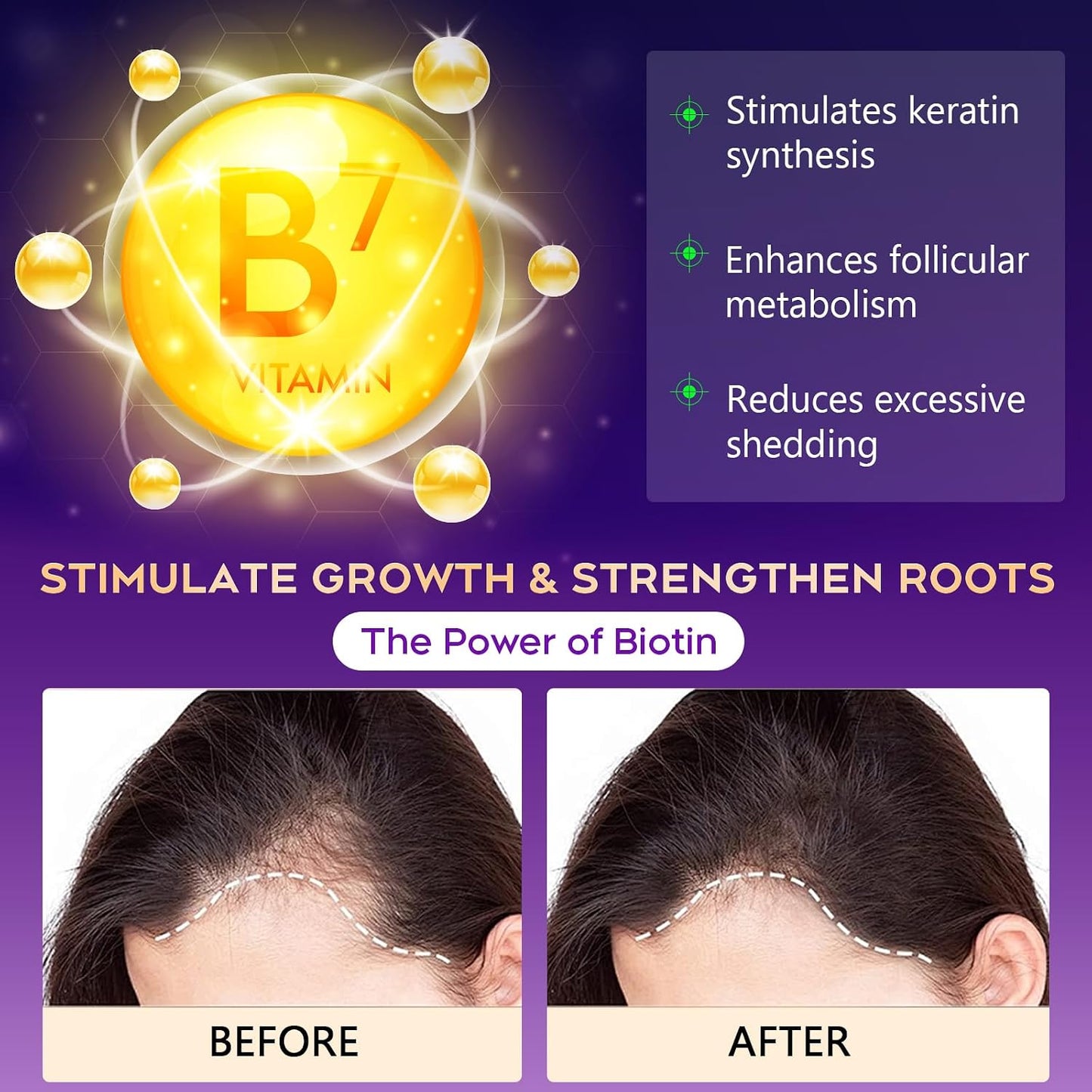 OELY Biotin Hair Growth Shampoo – Tea Tree, Ginseng & Mint | Sulfate-Free for Thinning Hair | 10.1 fl oz