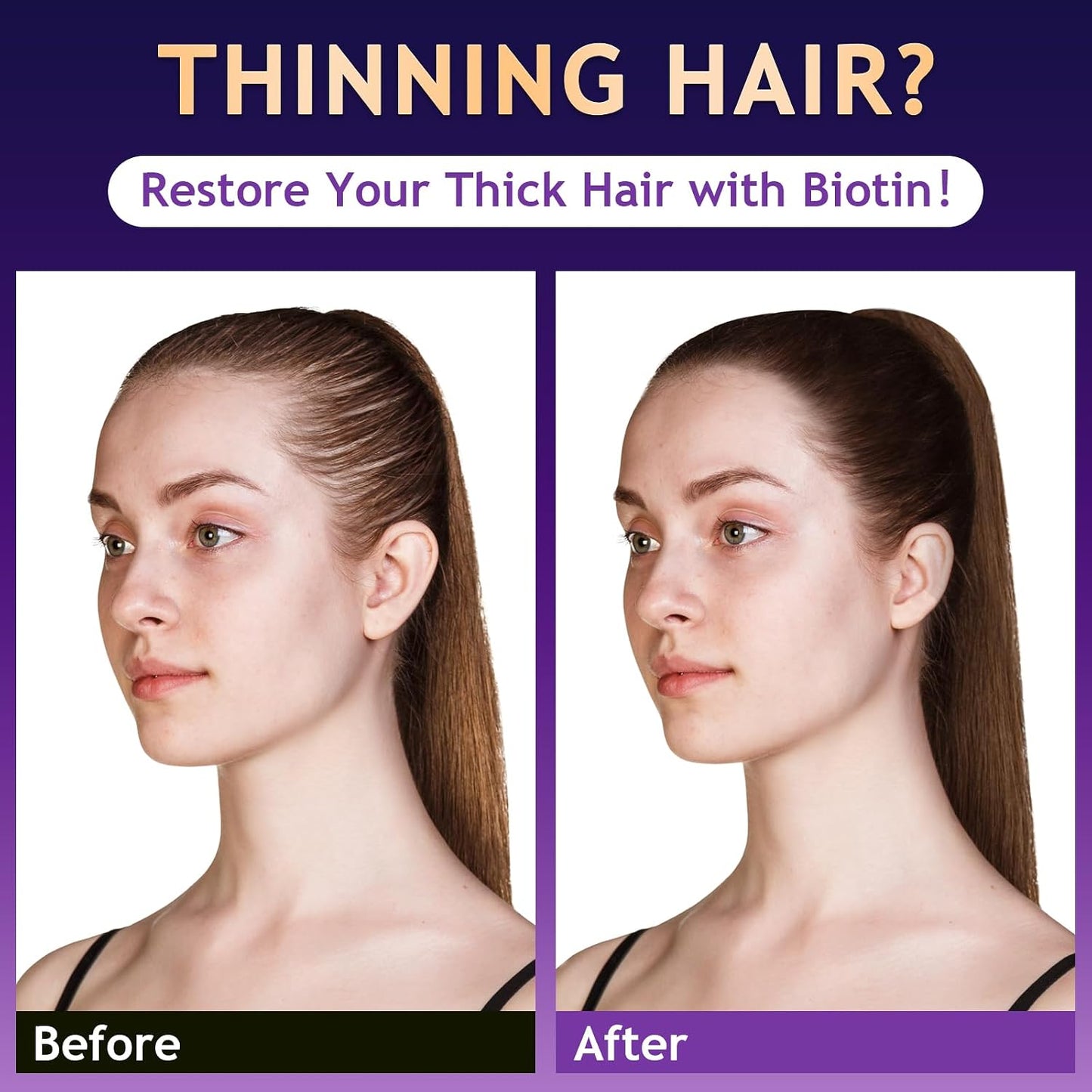 OELY Biotin Hair Growth Shampoo – Tea Tree, Ginseng & Mint | Sulfate-Free for Thinning Hair | 10.1 fl oz