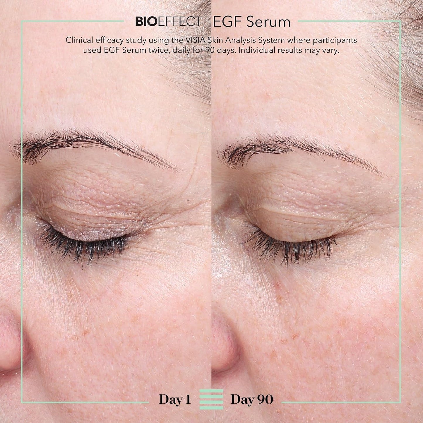 BIOEFFECT EGF Serum – Epidermal Growth Factor Face Serum | Hyaluronic Acid, Glycerin & Icelandic Water | Anti-Aging
