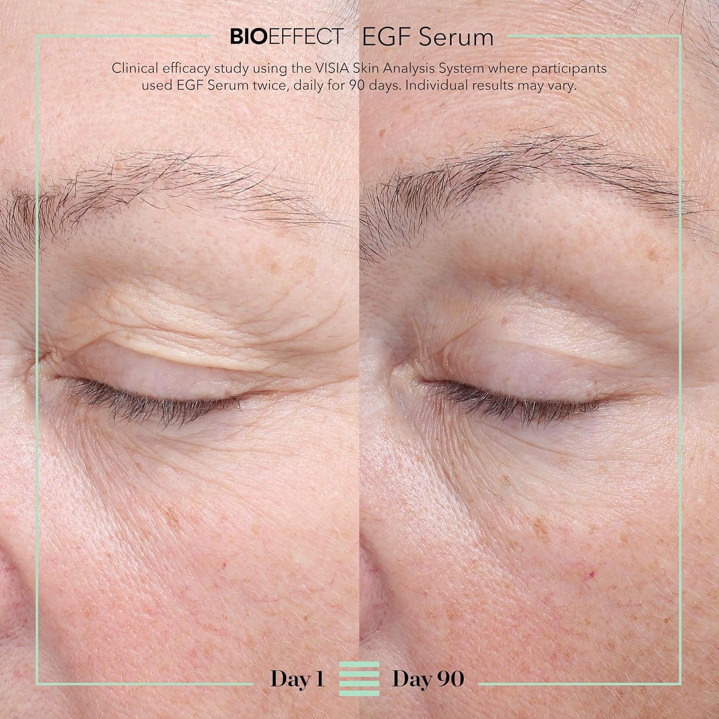 BIOEFFECT EGF Serum – Epidermal Growth Factor Face Serum | Hyaluronic Acid, Glycerin & Icelandic Water | Anti-Aging